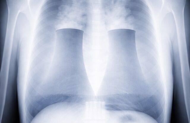 Harvard Studies Show Cancer Risk Near US Nuclear Reactors